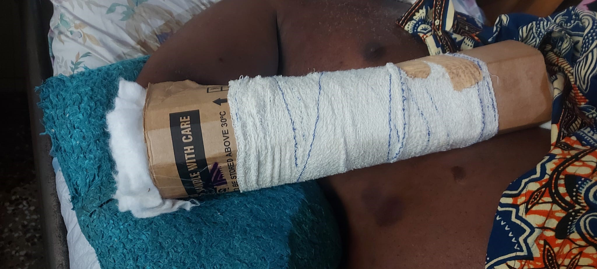 Fracturen SEH