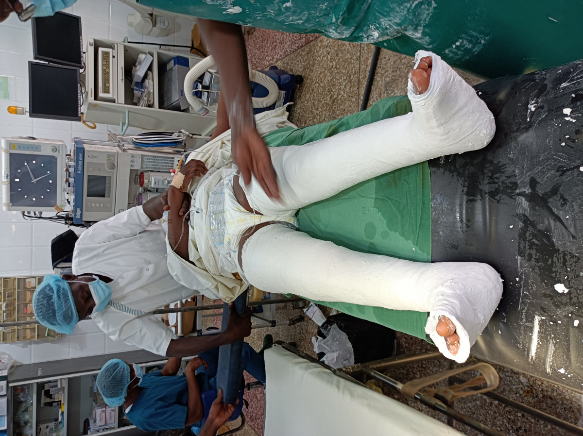 beencorrectie gips